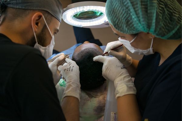 Unshaven Hair Transplant